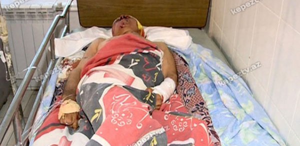 Azərbaycanda oğul atanın qulağını kəsdi- FOTOLAR
