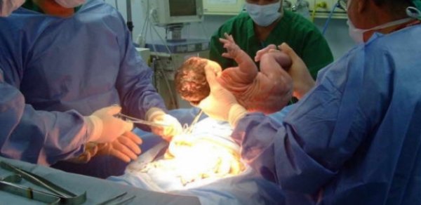 Bakıda doğuş zamanı ana və uşaq ölüb