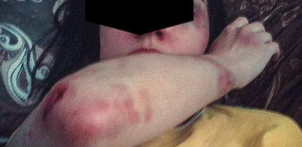 Bakıda cəhənnəm əzabı yaşadılan qadınla bağlı prokurorluq araşdırmaya başlayıb
