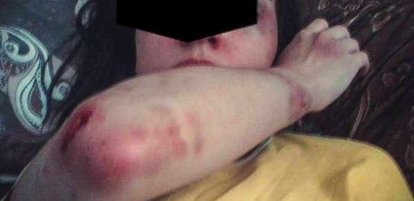 Sabunçuda hamilə qadını döyən kişi həbs olundu – FOTO