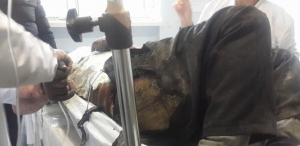 Sumqayıtda iki kişi özünü yandırdı –FOTO