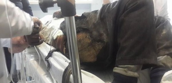 Sumqayıtda özünü yandıranlarla bağlı rəsmi məlumat