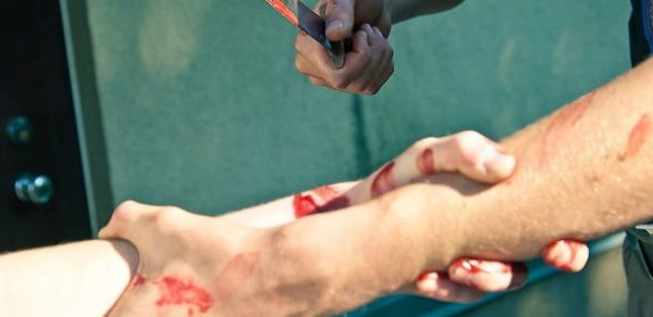 Sumqayıtda sevgilisinə 26 bıçaq zərbəsi vuran oğlan tutuldu