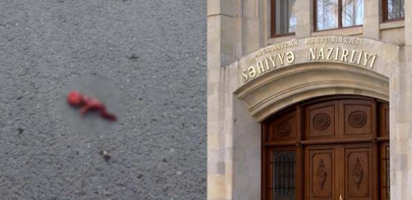 Səhiyyə Nazirliyindən Bakıda tapılmış embrionla bağlı-  AÇIQLAMA