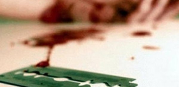 34 yaşlı qadın ülgüclə qollarını doğradı