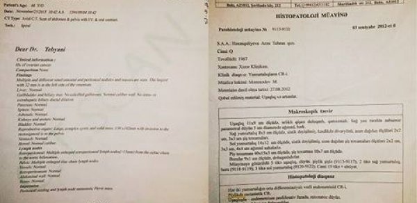 “Hər gecikdiyimiz gün anamın həyatı üçün təhlükə artır“