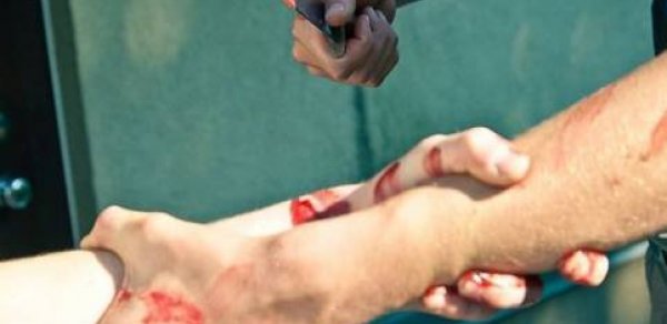 ‘Son zəng’ şənliyində qan töküldü -  Sevdikləri qıza görə