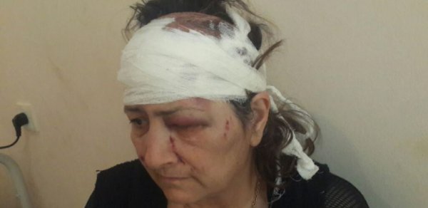 Azərbaycanda qayınana kürəkəni tərəfindən döyüldü
