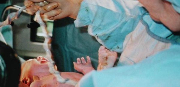 Azərbaycanda daha bir doğuş faciəsi - Əkiz oğlanlardan biri öldü