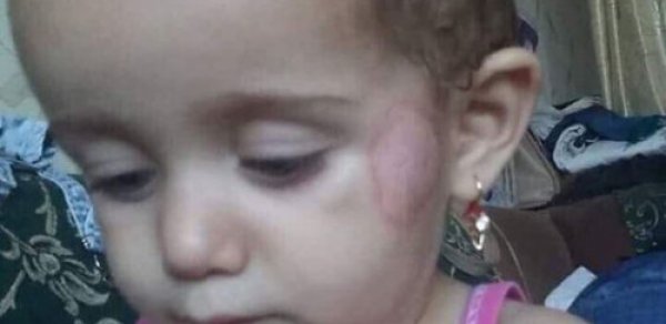 Bağçadakı işgəncəyə görə 2 nəfər işdən çıxarıldı