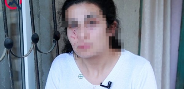 Bakıda zorlanmadan son anda qurtarılan qadın danışdı - Video