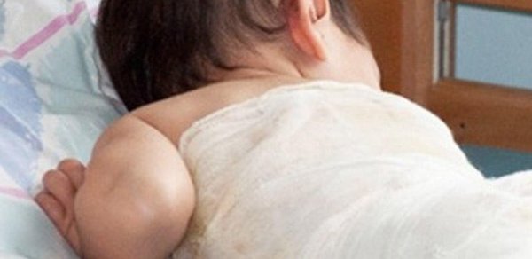 2 yaşlı uşaq xlor, 16 yaşlı qız kamfora yağı içdi