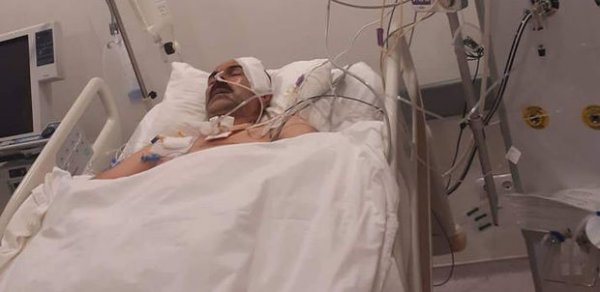 Oqtay Gülalıyevi süni nəfəs aparatından ayırıblar