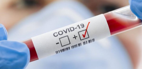 Azərbaycana bu günə qədər 44753 nəfər koronavirus testi verib