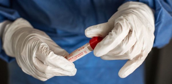 Azərbaycanda 67 nəfərdə koronavirus aşkarlandı, 1 nəfər vəfat etdi