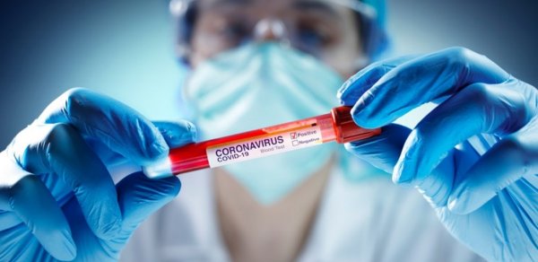 Azərbaycanda daha 139 nəfər koronavirusa yoluxdu