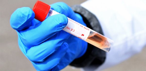Azərbaycanda koronavirusa yoluxanların sayı azaldı