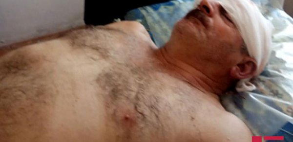 Ermənilərin yaraladığı mülki şəxs xəstəxanaya yerləşdirildi