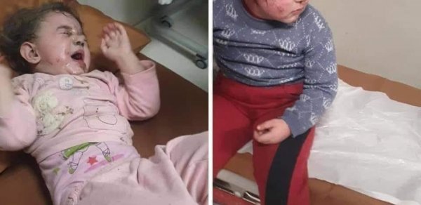 Gəncənin atəşə tutulması nəticəsində xəsarət alanlar arasında uşaqlar da var