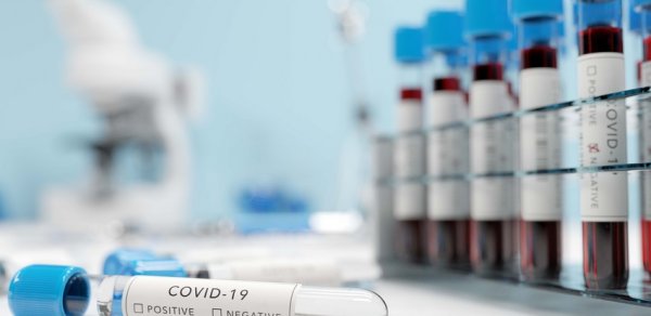 Daha 34 şagird və 21 işçidə koronavirus aşkarlandı