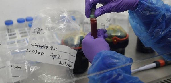 Gürcüstanda koronavirusa 357 yeni yoluxma qeydə alınıb