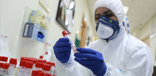Gürcüstanda son sutkada 258 koronavirusa yoluxma halı aşkarlanıb