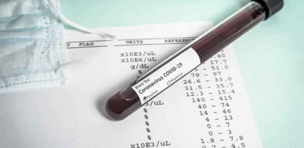 İndoneziyada koronavirus testinin cavabı 3 dəqiqəyə hazır olacaq