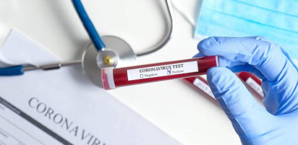 Gürcüstanda COVID-19-a yoluxma hallarının 80%-dən çoxu "Delta" ştammıdır