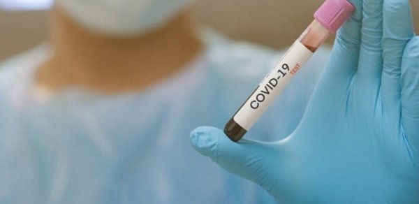 Ermənistanda COVID-ə yoluxanların sayı 420 498 nəfərə çatıb