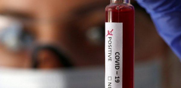 İranda daha 41 nəfər koronavirusdan ölüb
