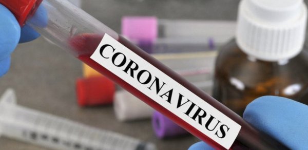 Rusiyada daha 5 466 nəfər koronavirusa yoluxub