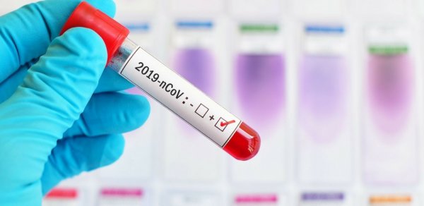 Gürcüstanda koronavirusla bağlı statistikanın gündəlik dərci dayandırılıb