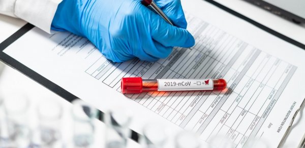 Azərbaycanda koronavirusa yoluxanların bu günə olan statistikası