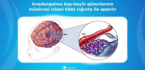 Bu əməliyyat da icbari tibbi sığorta ilə icra olunur