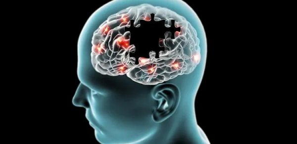 Alzheimer xəstələri üçün ağıllı bilərzik kəşf olundu