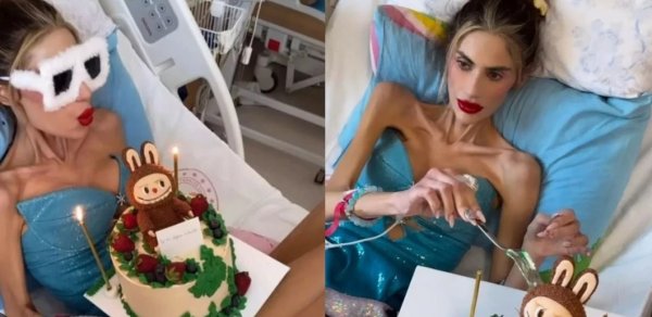 Anoreksiya xəstəsi olan fenomen daha 1 kilo arıqladı