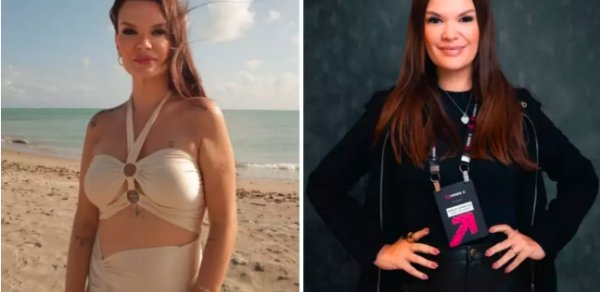 Sosial media fenomeni plastik əməliyyatdan sonra vəfat etdi - FOTOLAR