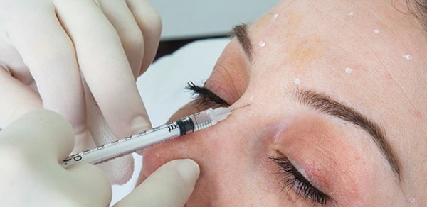 Botox və dolğu etdirənlərə - Rəsmi xəbərdarlıq