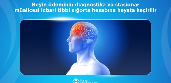 Beyin ödeminin müalicəsi icbari tibbi sığorta hesabına həyata keçirilir