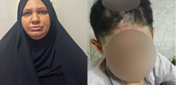 Xalası tərəfindən işgəncəyə məruz qalan yeniyetmə ilə bağlı YENİ XƏBƏR
