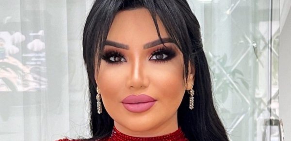 Nigar Şabanova plastik əməliyyat etdirib? - FOTO