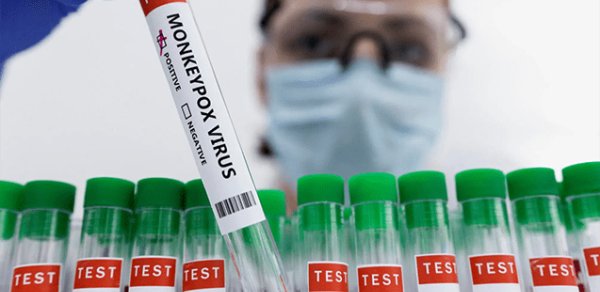 Rusiyada meymunçiçəyi virusuna yeni yoluxma qeydə alınıb