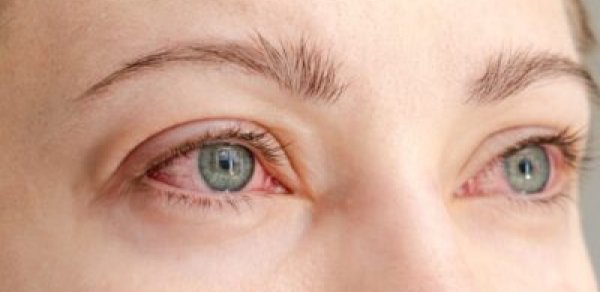 Çində yeni təhlükə: Gözə zərər verən virus aşkarlandı