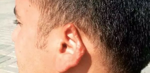 Əri ilə dalaşan qadın onun qulağını qopardı