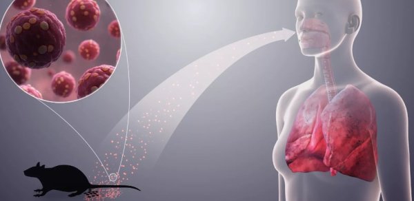 “Hantavirus” yoluxucudur? - ÜST-dən açıqlama