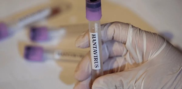 Fransada hantavirusa ilk yoluxma halı qeydə alınıb