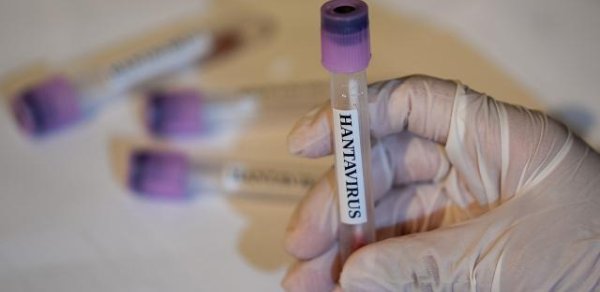 ÜST-dən hantavirus xəbərdarlığı: Yeni yoluxmalar arta bilər