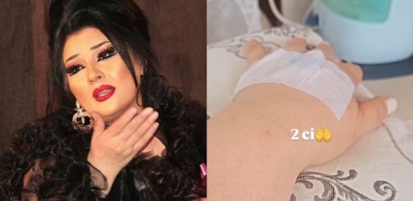 Aybəniz Haşımovanın paylaşımı sevənlərini qorxutdu - FOTO