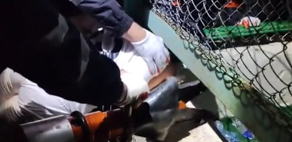 Bakıda stadionda 11 yaşlı uşağın başına iş gəldi - XİLASEDİLMƏ GÖRÜNTÜLƏRİ