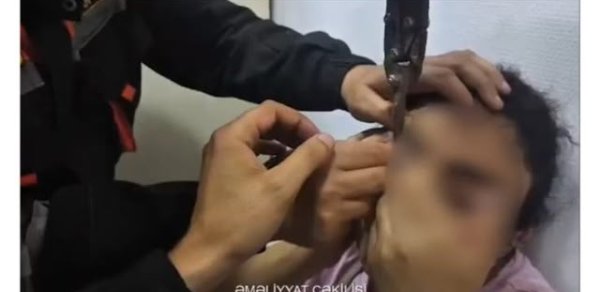 Sabunçuda göz qapağı paltar zəncirbəndinə ilişən qadın xilas edildi - VİDEO